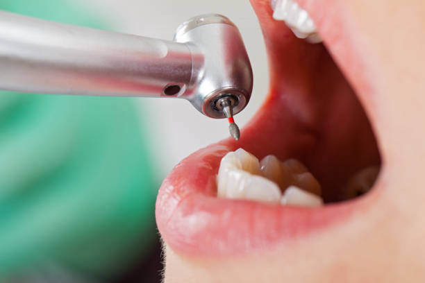 Best Emergency Gum Treatment in Bertville, AL